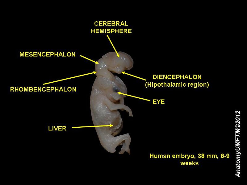 Main Difference - Embryo vs Foetus vs Gamete vs Zygote