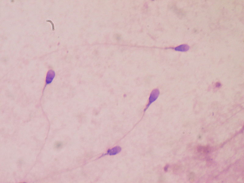 Difference Between Embryo Foetus Gamete and Zygote - 3