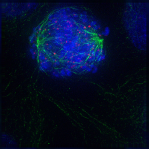 What are the Stages of Mitosis_Image of Early Prometaphase