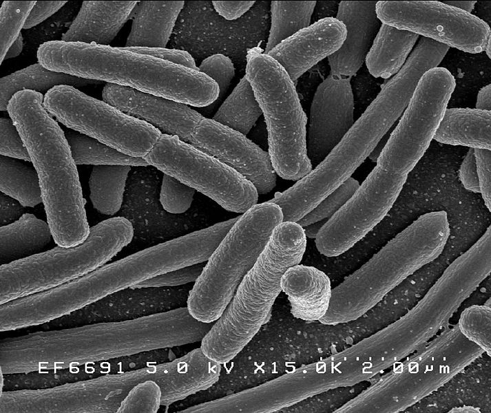Main Difference - Archaebacteria vs  Eubacteri