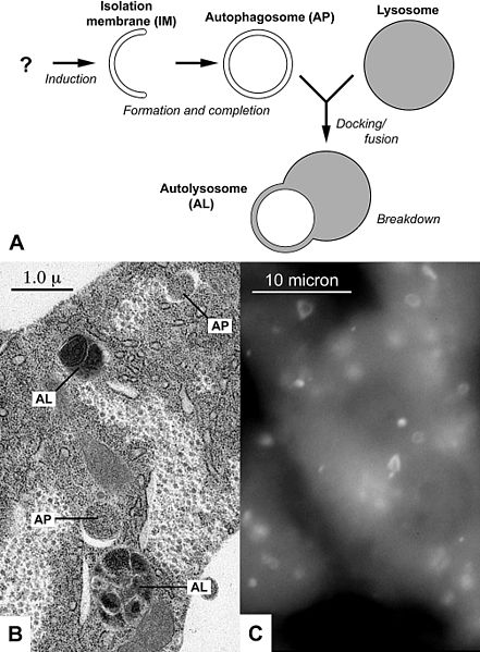 Difference Between Autophagy and Apoptosis