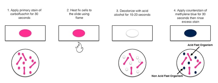 Difference Between Acid Fast And Non Acid Fast Bacteria Definition Features Examples 4674