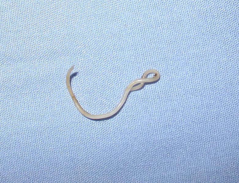 Main Difference - Roundworm vs Tapeworm