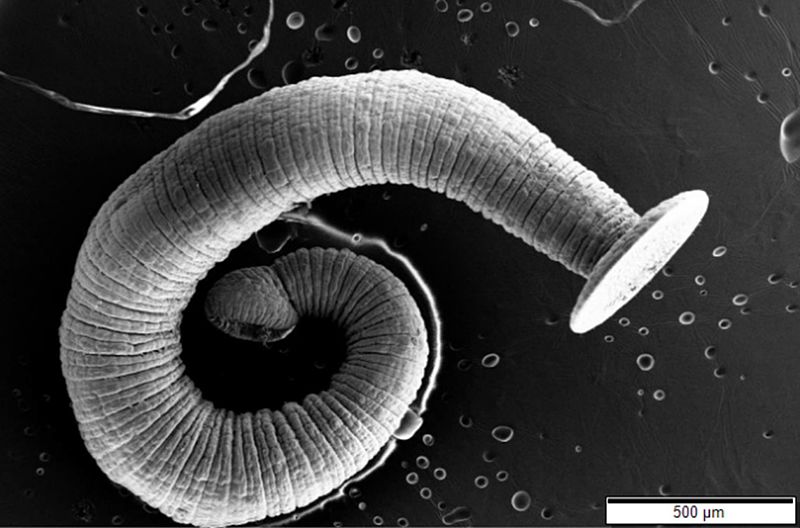 difference-between-roundworm-and-tapeworm-definition-body-structure