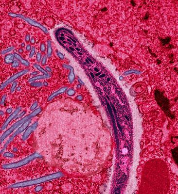 Difference Between Infection and Infestation