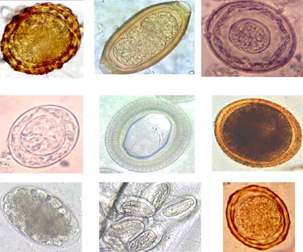 difference-between-ova-and-cyst-definition-facts-structure-differences