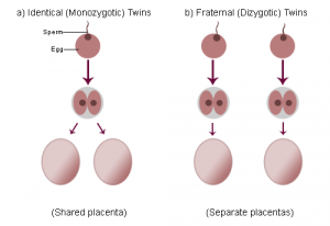 Difference Between Identical And Fraternal Twins | Definition ...