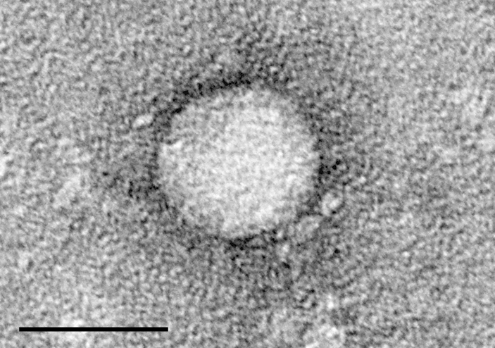 difference-between-positive-and-negative-sense-rna-virus-definition