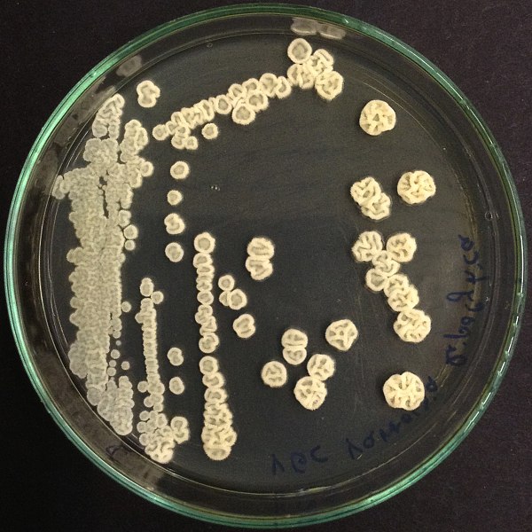 Main Difference- Bacterial and Fungal Colonies
