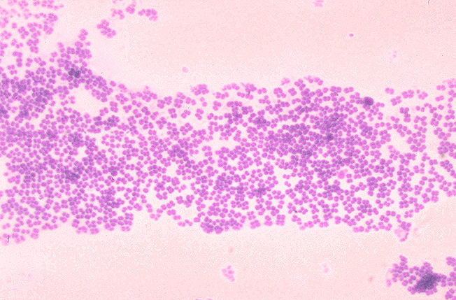 Difference Between Micrococcus and Staphylococcus