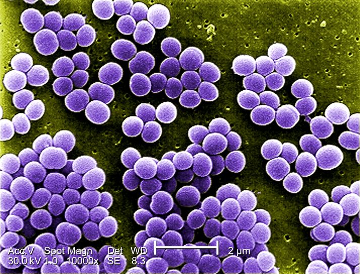 Main Difference - Micrococcus and Staphylococcus