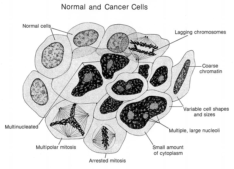 What is the Difference Between Cancer Cells and Normal ...