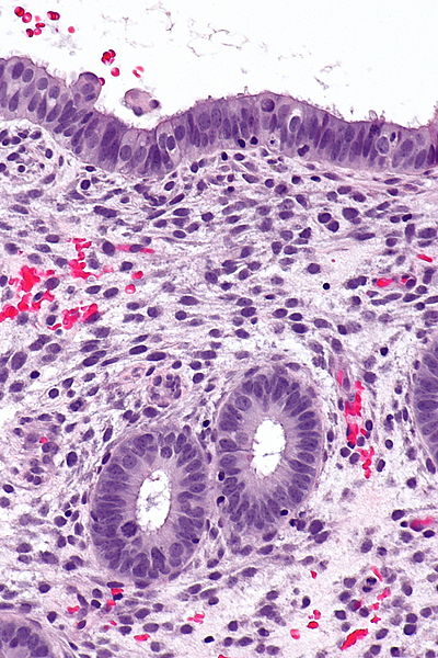 Difference Between Endometrium and Myometrium - Pediaa.Com