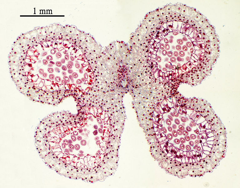 Difference Between Megasporangium and Microsporangium ... diagram of a sporangium 