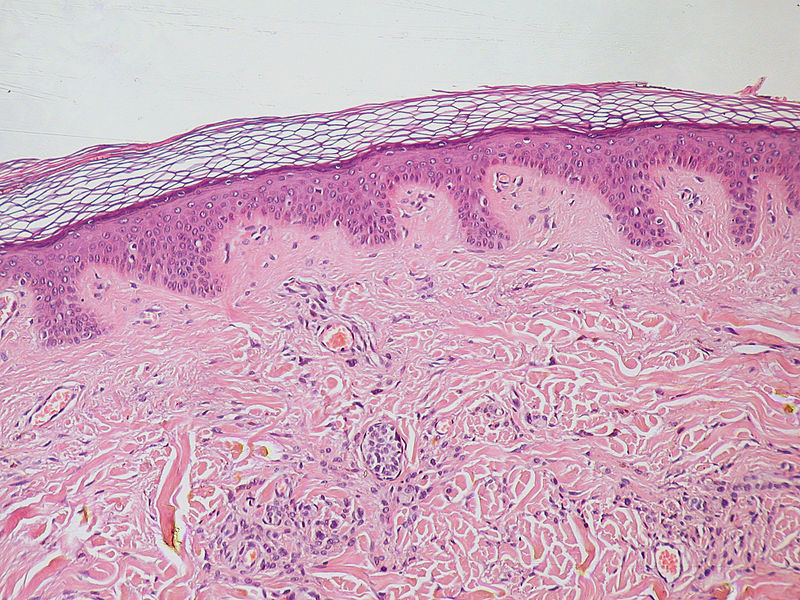 What is the Difference Between Benign and Malignant_Fig 01
