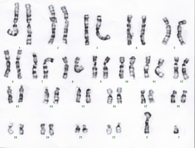 what-is-the-difference-between-maternal-and-paternal-chromosomes