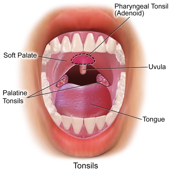 What Are The Main Types Of Tonsils