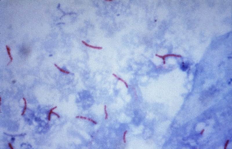 Difference Between Gram Stain and Acid Fast