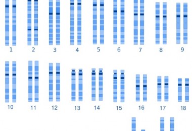 What is the Difference Between Normal and Abnormal Karyotype – Pediaa.Com