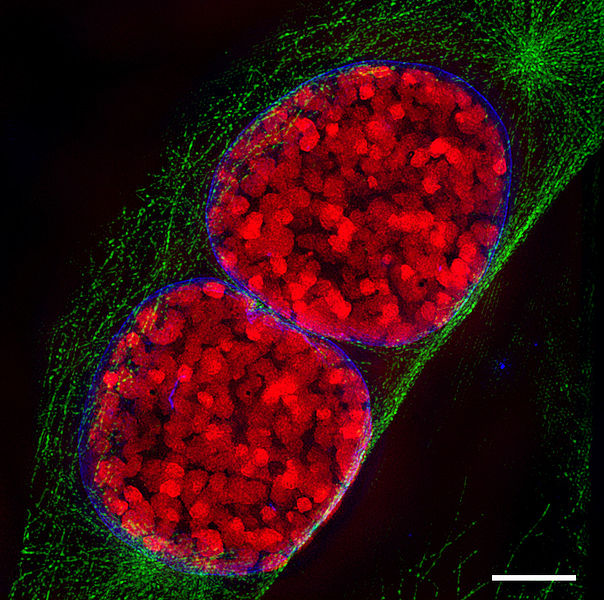 Difference Between Prophase and Metaphase
