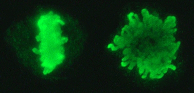 What is the Difference Between Prophase and Metaphase
