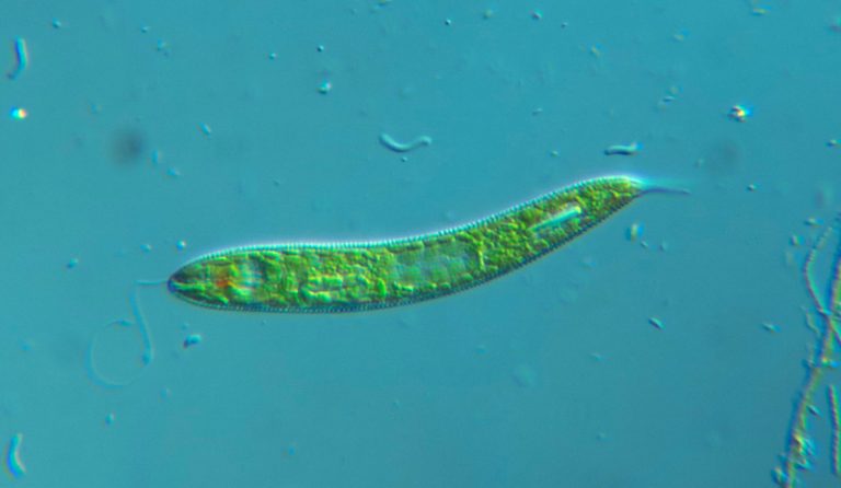 What Is The Difference Between Protozoa And Metazoa Pediaa Com