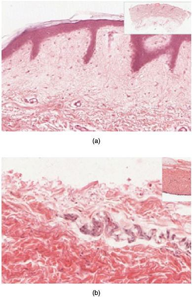 skin-notes-skin-specific-outcomes-discuss-the-o-histology-of-the