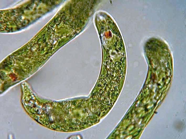 Main Difference - Amoeba and Euglena