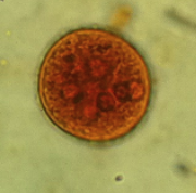 Entamoeba Histolytica vs Entamoeba Coli