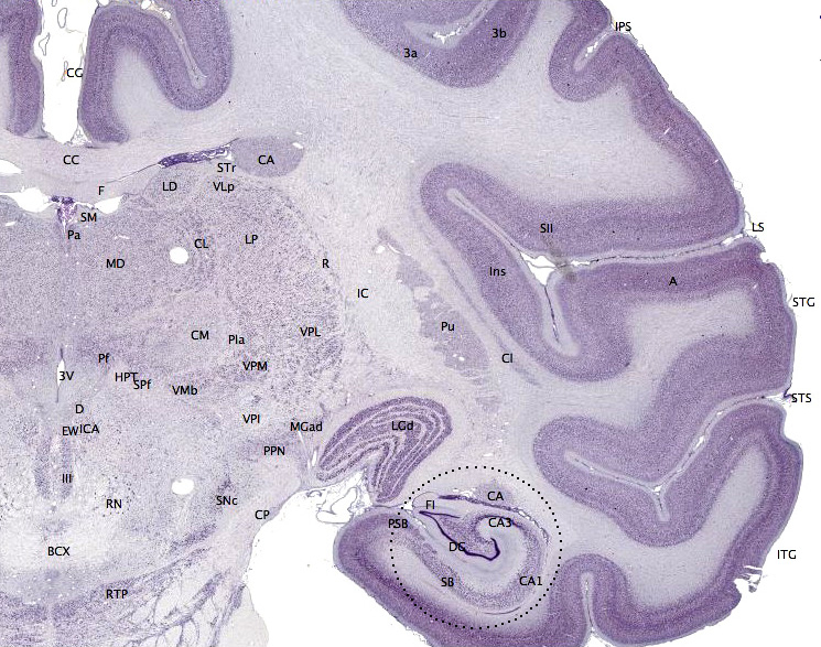 What is the Difference Between Neocortex and Cerebral Cortex - Pediaa.Com