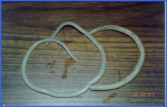Platyhelminthes vs Aschelminthes