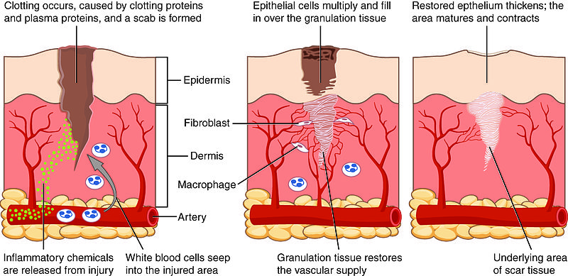 Difference Between Repair and Regeneration