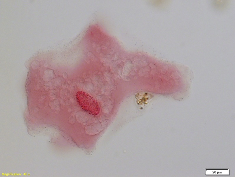 Endoplasm vs Ectoplasm
