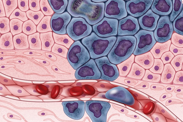 Difference Between Hematology and Oncology