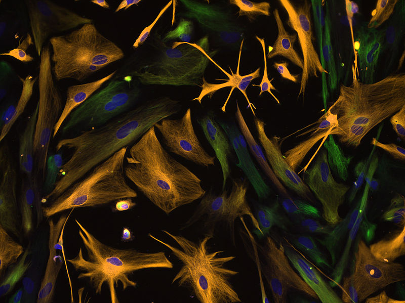 Difference Between Progenitor and Precursor Cells