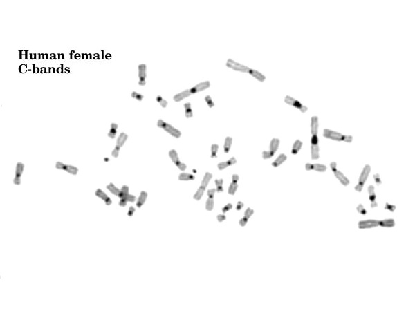 Constitutive vs Facultative Heterochromatin