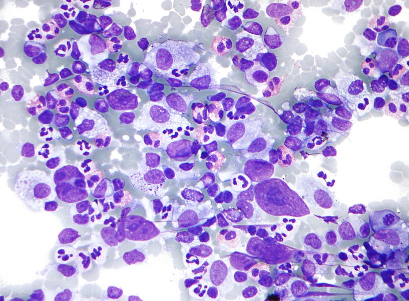 What is the Difference Between Cytology and Histology  Pediaa.Com