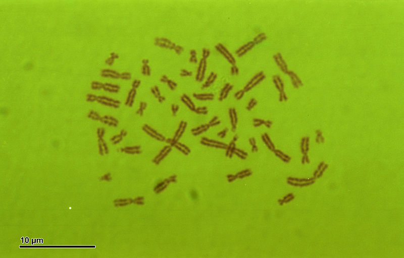 What Is The Difference Between Karyotype And Karyogram Pediaa Com