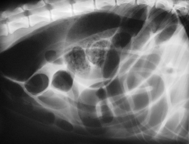 What Is The Difference Between Torsion And Volvulus Pediaacom