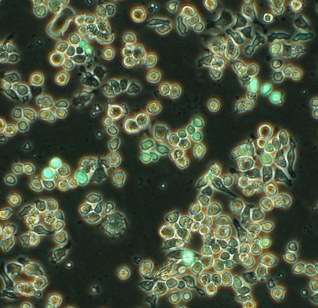 Difference Between Transient and Stable Transfection