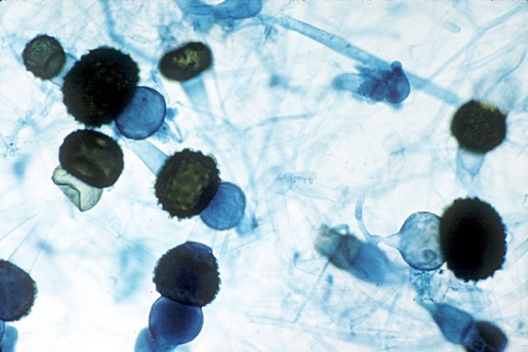 What is the Difference Between Zoospore and Zygospore