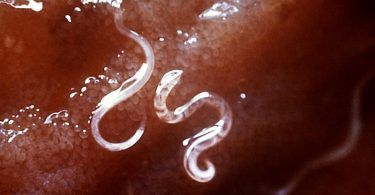 Difference Between Hookworm and Roundworm