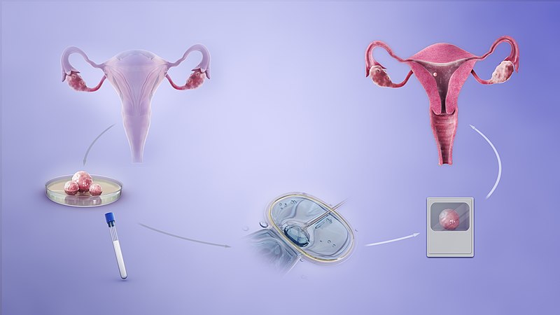 Infertility vs Subfertility
