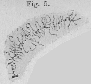 Polytene vs Lampbrush Chromosome