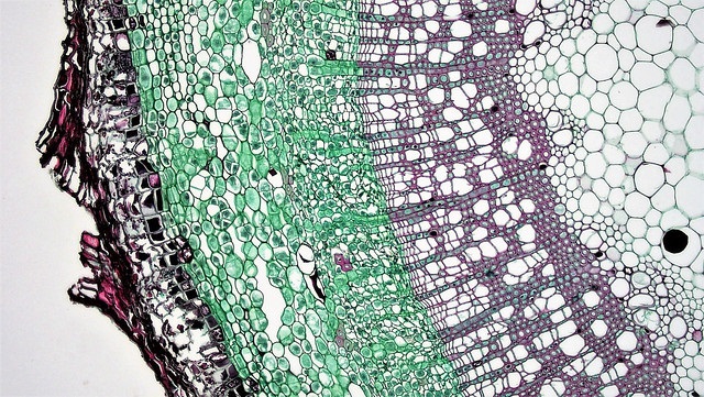 What is the Difference Between Stomata and Lenticels