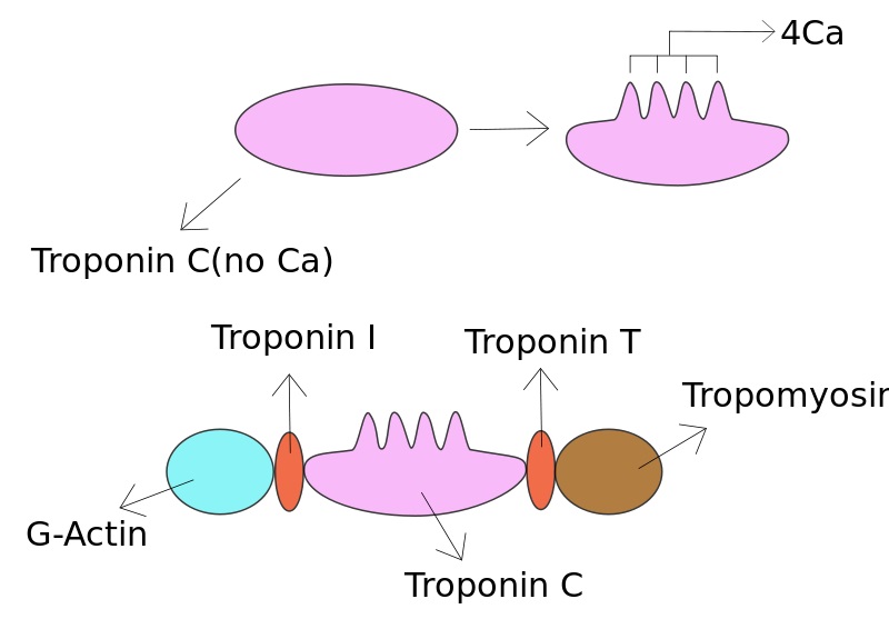 Difference Between Troponin I and Troponin T