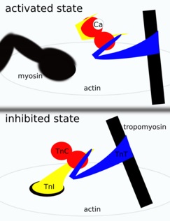 Troponin I vs Troponin T