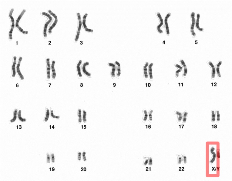 What Is The Difference Between Xx And Xy Chromosomes Pediaa Com