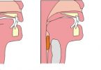 Difference Between Open and Closed Circulatory System | Definition ...