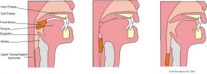 What is the Difference Between Bolus and Chyme - Pediaa.Com